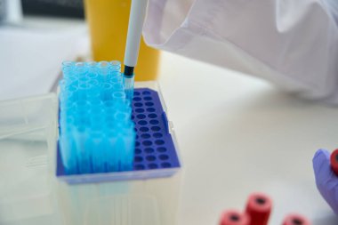 Conducting a diagnostic analysis of biomaterial in the laboratory, test tubes are collected in a special block