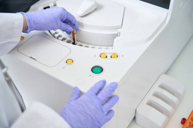 Laboratory assistant puts a test tube with a blood sample into an immunochemiluminescent analyzer, this is a modern diagnostic apparatus
