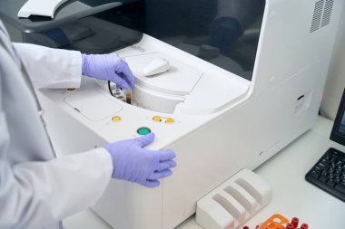 Laboratory assistant removes a test tube with a blood sample from a hematological analyzer, this is a modern diagnostic apparatus