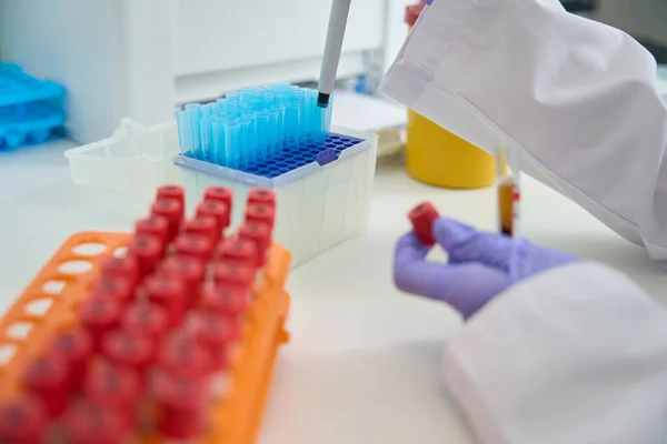 Testbuizen Met Biomateriaal Het Laboratorium Worden Verzameld Blokken Laboratoriumassistent Werkt — Stockfoto