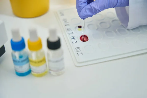 Hematologist Works Blood Samples Indication Palette Clinical Laboratory Next Bottle — Fotografia de Stock