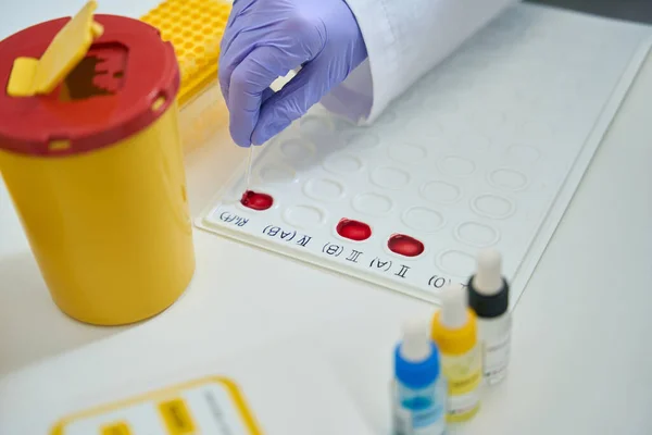 Laboratory Assistant Works Blood Samples Indication Palette Clinical Laboratory Specialist — Fotografia de Stock