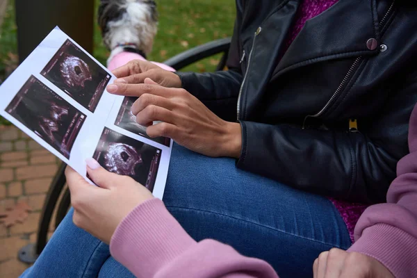 トリミングされた写真の女性Pointingで胎児オンSonogramへ彼女の女性コンパニオン座って公園ベンチ — ストック写真