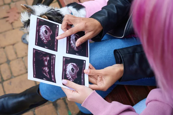 彼女のパートナーにソノグラムで胎児を指している女性の作物の写真ベンチに座って — ストック写真