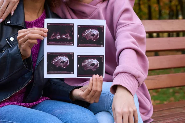 의자에 여성의 태아의 초음파 사진을 여성의 — 스톡 사진