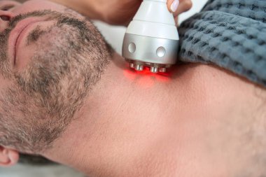 Kozmetik uzmanı, tıp merkezindeki RF kaldırma prosedüründe tıraş olmamış bir erkek, modern bir cihaz kullanıyor.