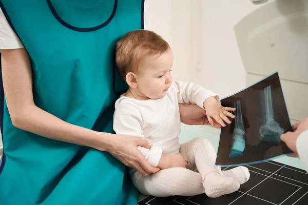 Kisgyermek Vizsgálóasztalon Anyjával Megható Láb Radiográf Orvos Kezében — Stock Fotó