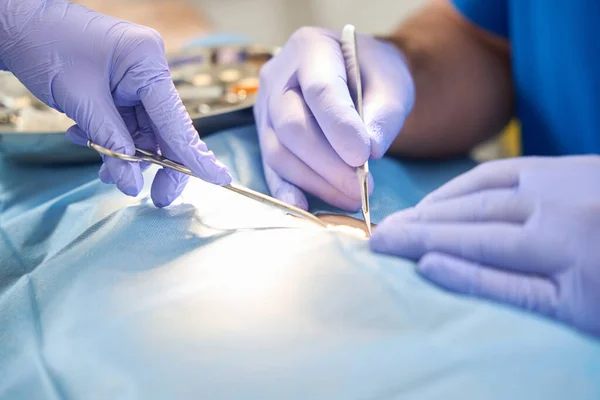Foto Mãos Luvas Médicas Cirurgião Seu Assistente Durante Operação Cirúrgica — Fotografia de Stock