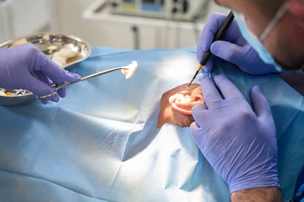 Zdjęcie Pracy Chirurga Plastycznego Który Wykonuje Operację Ucha Pacjenta Pomocą — Zdjęcie stockowe