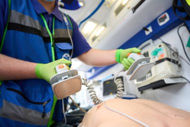 Elinde defibrilatör elektrotları olan bir sağlık görevlisi. Ambulansta bir hastayı canlandırıyor.