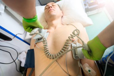 Doktor ambulansta genç bir adamı hayata döndürüyor. Defibrilatör kullanıyor.