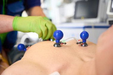 Sıhhiye, emme bardaklarına elektrotları ambulanstaki bir adamın gövdesine yerleştirip kardiyogram çeker.