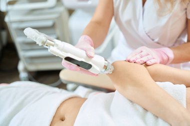 Kadın kozmetolojistin, bulanık güzellik salonundaki IPL fotorejuvenation cihazıyla dirsek derisini mikronedle kaldırırken çekilmiş görüntüsü. Vücut bakımı ve gençleştirme kavramı