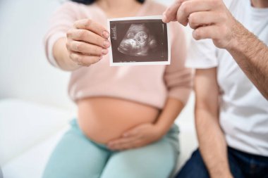 Doktor ofisinde muayene koltuğunda oturan mutlu çift ve ellerinde sağlıklı çocuklarının ultrasonografi fotoğrafı, derin sevgi ve şefkat, sağlık ve tıp.
