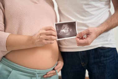 Sevgi dolu koca ve hamile karısının el ele tutuşması ultrason görüntüsü, yakın plan, jinekoloji ve üreme kavramı.