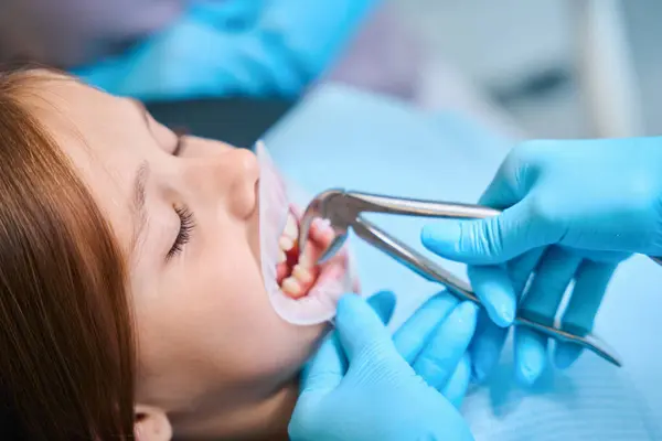 Dziecko Poddaje Się Ekstrakcji Zęba Dentysty Dziewczyna Zwijacz Dentystyczny Ustach — Zdjęcie stockowe