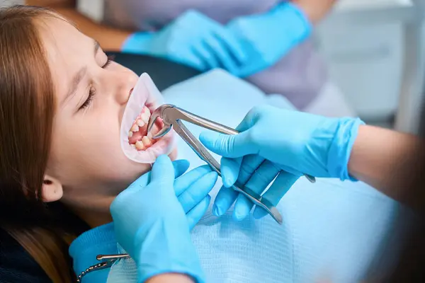 Zahnarzt Entfernt Einen Zahn Eines Mädchens Mit Einem Speziellen Werkzeug — Stockfoto
