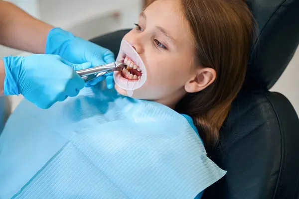 Procedure Removing Tooth Child Girl Has Dental Retractor Her Mouth — Stock Photo, Image