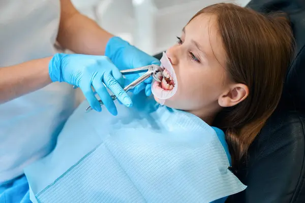 Verfahren Zur Entfernung Eines Kinderzahns Der Zahnarzt Verwendet Spezielle Werkzeuge — Stockfoto