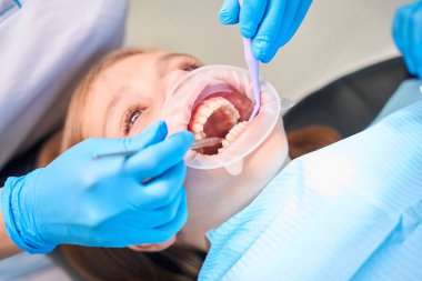 Dişçi tartar temizlemek için özel aletler kullanır, bir kız diş çıkarıcı ile sandalyeye oturur.