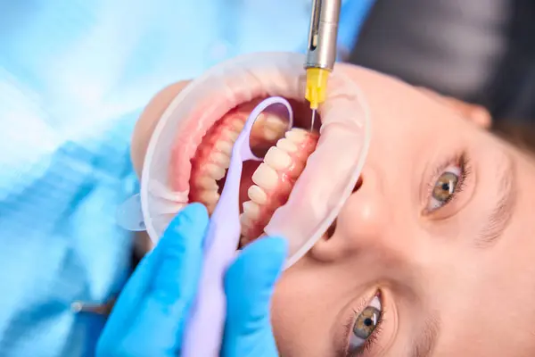 Doctor Gives Injection Anesthesia Gum Teenage Girl Specialist Uses Thin — Stock Photo, Image