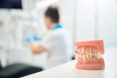 Hasta dişlerini zamanla doğru konumlarına getirmek için sürekli basınç kullanan diş telli çocuk çenesinin 3D modeli, ortodontist ofis randevusu