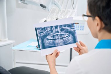Yüksek nitelikli kadın periodontist hasta çenesinin dişli röntgen görüntüsünü inceliyor, iltihaplı kökler ve dolguların altında çürüme arıyor, özen ve profesyonel yaklaşım