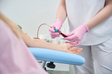 Yakın plan kadın hasta damar yoluyla ilaç alıyor tıbbi prosedür kanepesinde oturuyor, vücut temizliği ve gençleştirme, estetik tıp kliniği...