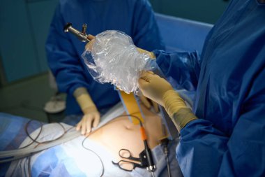 Rahmi çıkarmak için endoskopik ameliyat. Doktorlar ameliyata hazırlanıyor. Sağlık ve Tıp Konsepti