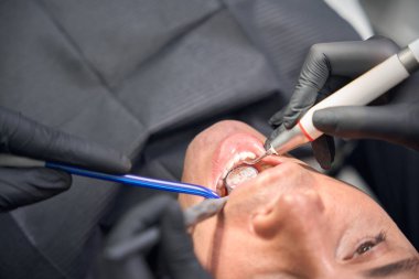 Yakın plan diş hekimi ağız aynasına bakıyor ve özel küreler kullanarak erkek müşteriye tartar ve plaket çıkarıyor. Sağlıklı bir gülümseme, estetik dişçilik ve estetik makyaj sağlıyor.