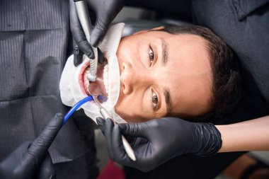 Diş doktorları diş tedavisi üzerinde çalışırken ağzı açık bir şekilde diş sandalyesinde yatan diş hekiminin erkek müşterisine tepeden bakılacak.