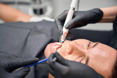 Estetik diş hekimi, dişçi koltuğunda ağzı açık bir şekilde yatarken profesyonel aletlerle dişlerini temizleyip beyazlatıyor.