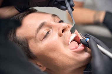 Diş macunu ve ağız aynası gibi özel aletler kullanarak diş hekiminin interdental alanını temizleyen deneyimli bir diş hekimi.