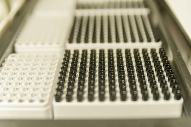 Kan tahlili için teknik laboratuvar ekipmanları. analiz laboratuvarı