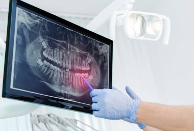 Eldivenli el doktoru diş röntgenini dijital ekranda, diş kliniğinde, arka planda tıbbi ekipmanlarla gösteriyor. Gülümse sağlıklı diş konsepti, kapat.