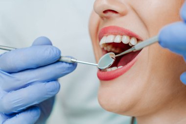 Diş sağlığı kliniğinde beyaz dişli çekici bir genç kadın. Tıbbi aletlerle el doktoru diş hekimi. Sağlıklı diş konsepti