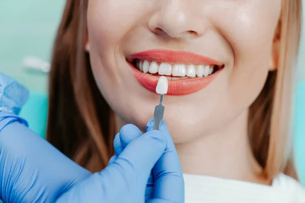 Usmívající Samičí Ústa Přirozenými Bílými Zuby Světle Modrém Pozadí Zubní — Stock fotografie