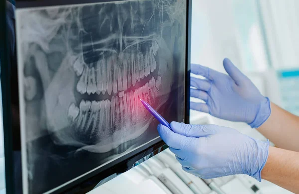 Manos Doctor Dentista Guantes Muestran Los Dientes Rayos Pantalla Digital — Foto de Stock