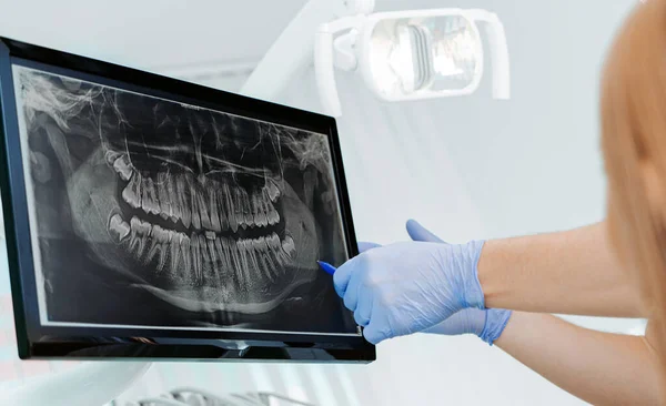 Manos Doctor Dentista Guantes Muestran Los Dientes Rayos Pantalla Digital — Foto de Stock