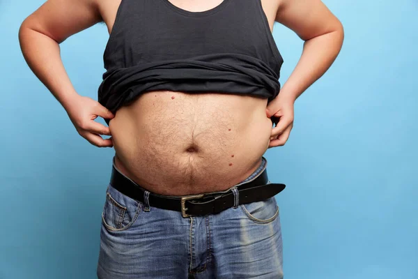 Cropped image of overweight man showing his belly, abdomen. Close up part of mans body. Concept of dieting, sport, fitness, body positive. Liposuction and plastic surgery