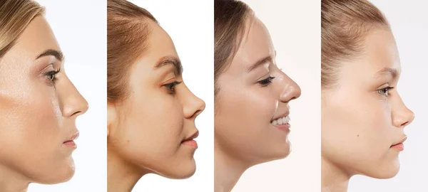 Face Building Closeup Portraits Women Female Chin Cheeks Nose Isolated — Stock Photo, Image