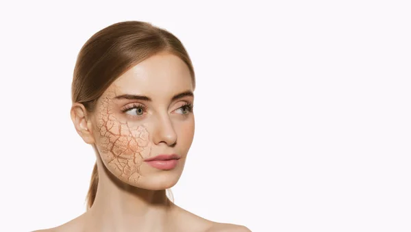 Beautiful Girl Dry Facial Skin Moistening Isolated White Background Skincare — Stock Photo, Image