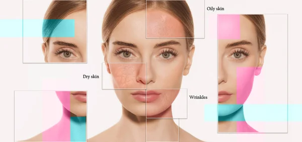 Koláž Ženské Kožní Problémy Zblízka Krásná Brunetka Nemoci Obličeje Akné — Stock fotografie