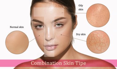 Female face with different skin types - dry, oily, normal, combination. T-zone. Skin problems. Beautiful brunette woman and facial diseases: acne, wrinkles. Skincare, healthcare, beauty, aging process clipart