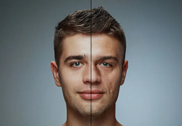2つの年齢の段階で若い男の肖像画 若さと成熟 顔の皮膚の老化プロセス 美容整形手術です 概念の前と後 老化と若返りのプロセス コラージュ — ストック写真