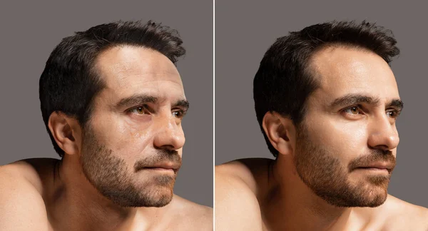 若返りの前と後の成熟した男の2つの肖像画のコラージュ 顔の皮膚の老化プロセス しわやたるんだ肌の外観 整形外科 健康的なライフスタイル — ストック写真
