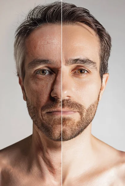 2つの年齢段階で成熟した男のクローズアップ肖像画 成熟と高齢 顔の皮膚や髪の老化プロセス しわやたるんだ肌の外観 老化と若返りのプロセス コラージュ — ストック写真