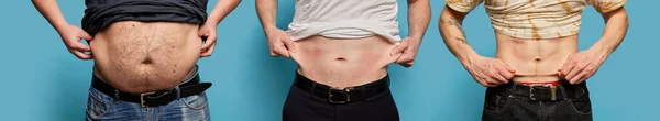 彼らの腹 腹部を示すスリムで太りすぎの男性のクロップ画像とコラージュ 人間の体の一部を閉じてください スポーツ フィットネス 体の正の概念 脂肪吸引とプラスチック手術 — ストック写真