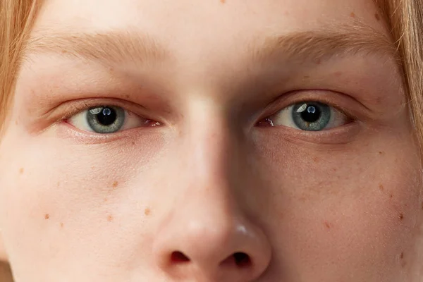 Close Portrait Young Redhead Man Blue Eyes Moles Face Eyes — Stock Photo, Image