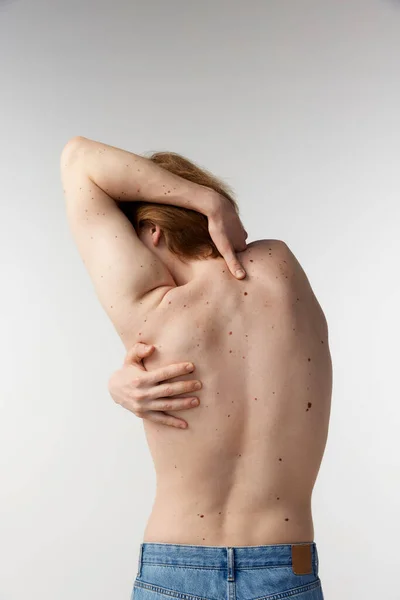 Rear view photo of young man posing shirtless in jeans over grey studio background. Moles on body, healthy strong back, spine. Concept of mens health, body and skin care, hygiene and male cosmetology